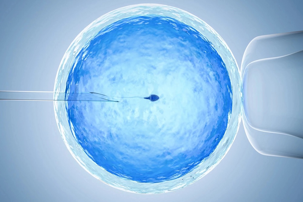 From Prognosis to Parenthood: How ICSI Makes a Distinction – 7 Days Luck